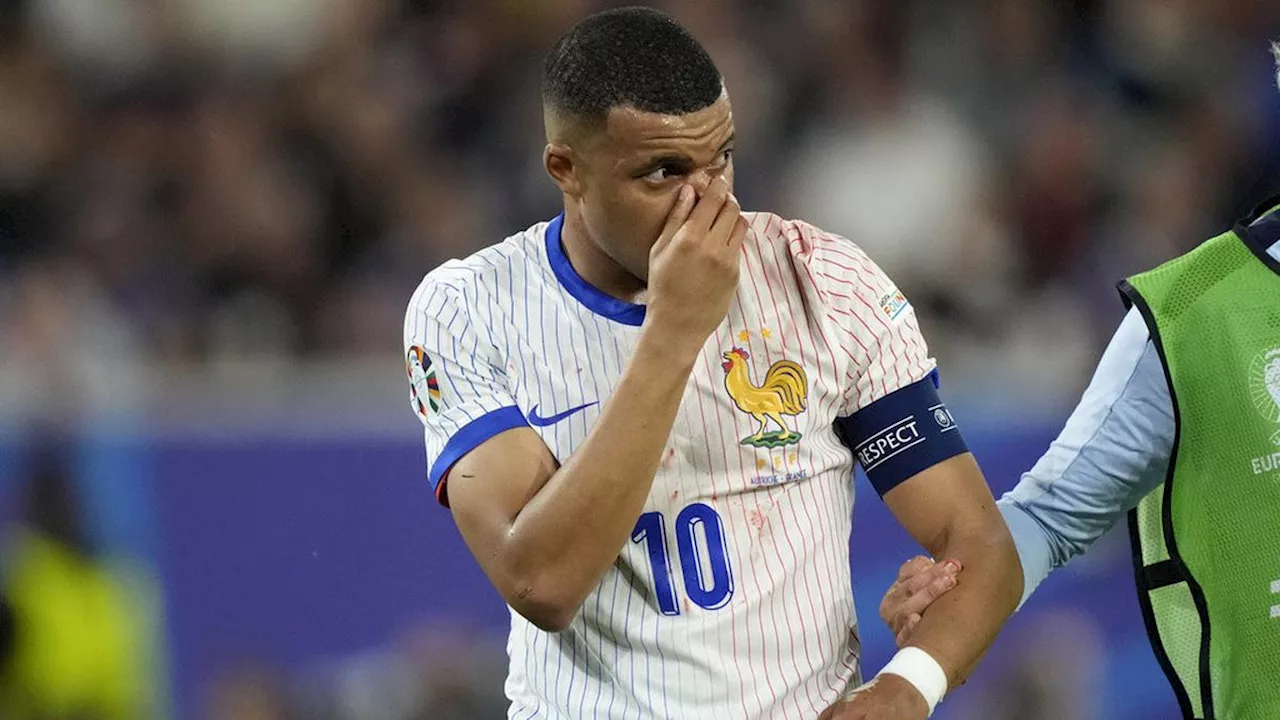 Euro 2024: Kemenangan Prancis Atas Austria Harus Dibayar Mahal, Kylian Mbappe Alami Cedera Parah