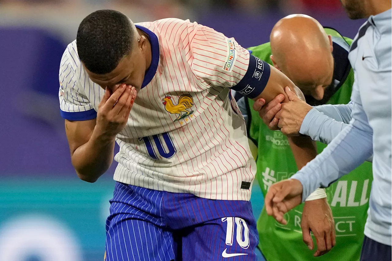 Mbappé's nose injury places doubt on his continued involvement in Euro 2024