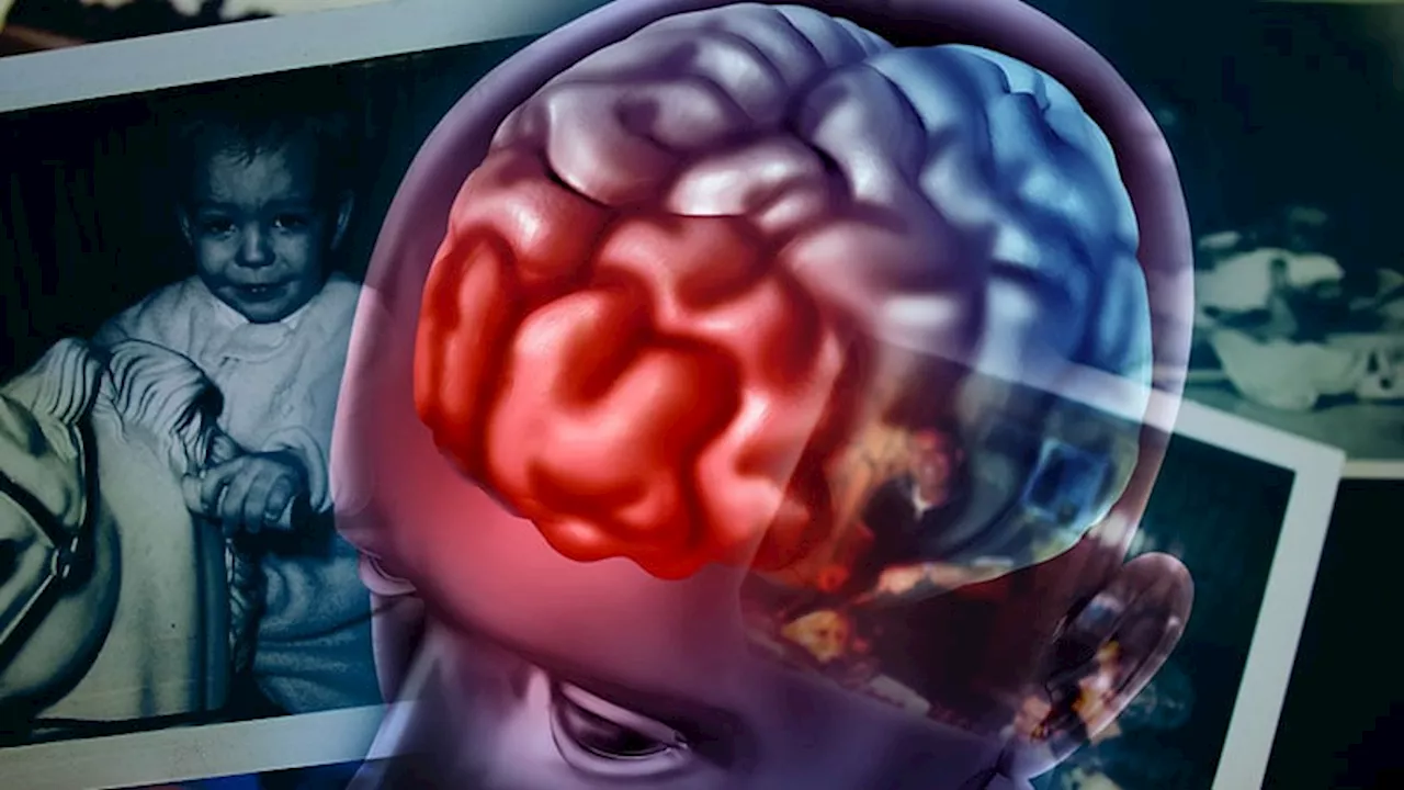 TBI Linked to Higher Risk for Schizophrenia, Bipolar Disorder