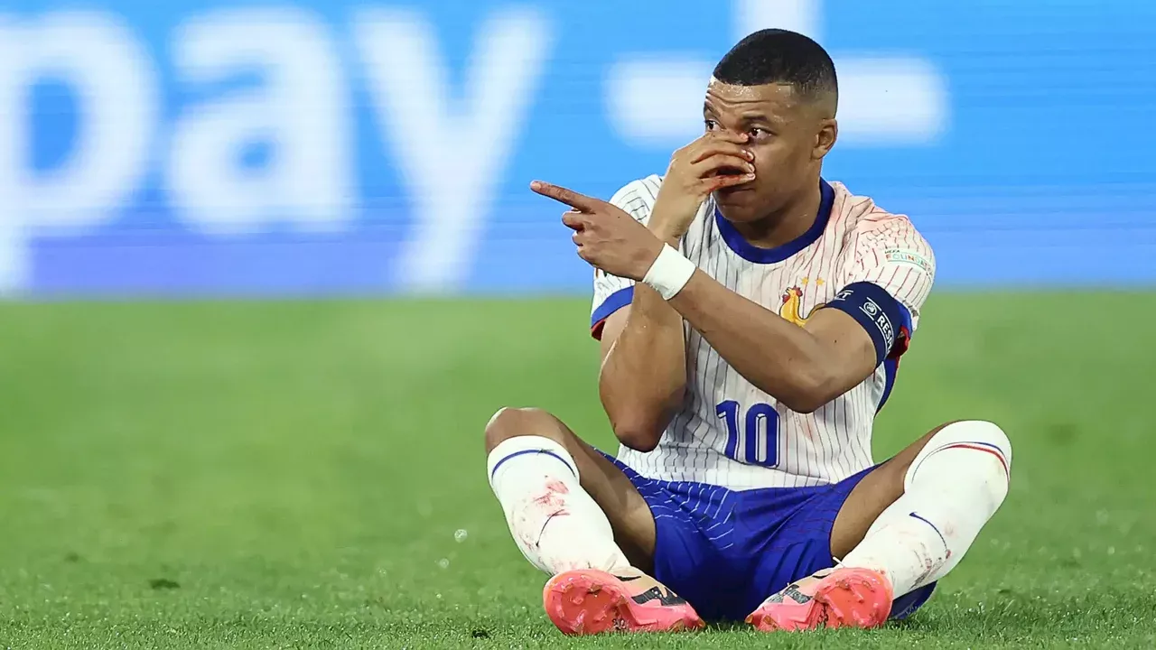 Kylian Mbappé se rompió la nariz: Francia tomó decisión sobre su continuidad en la Euro