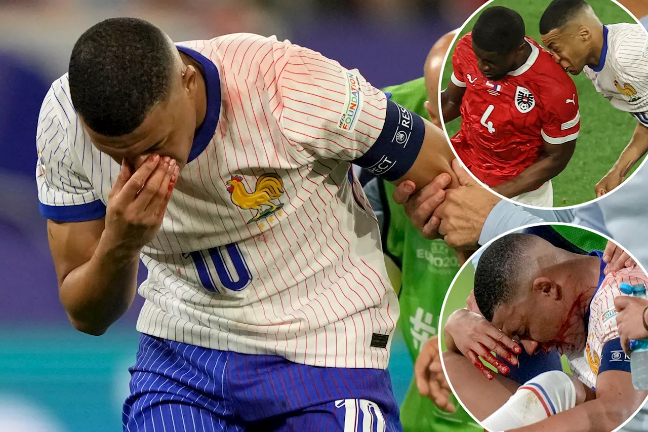 Kylian Mbappé's UEFA Euro 2024 return comes into focus after frightening injury