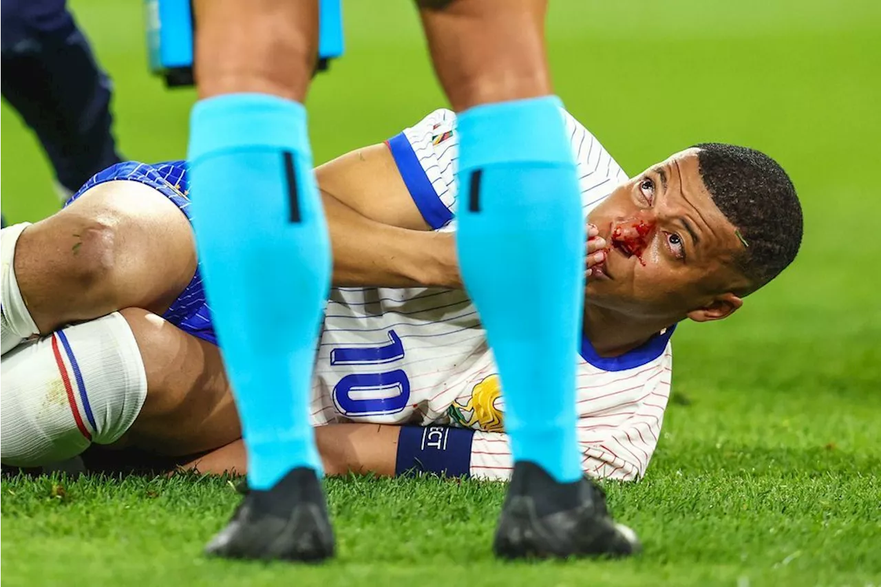  Verletzungen im Ticker: Mbappe droht Ausfall gegen Niederlande