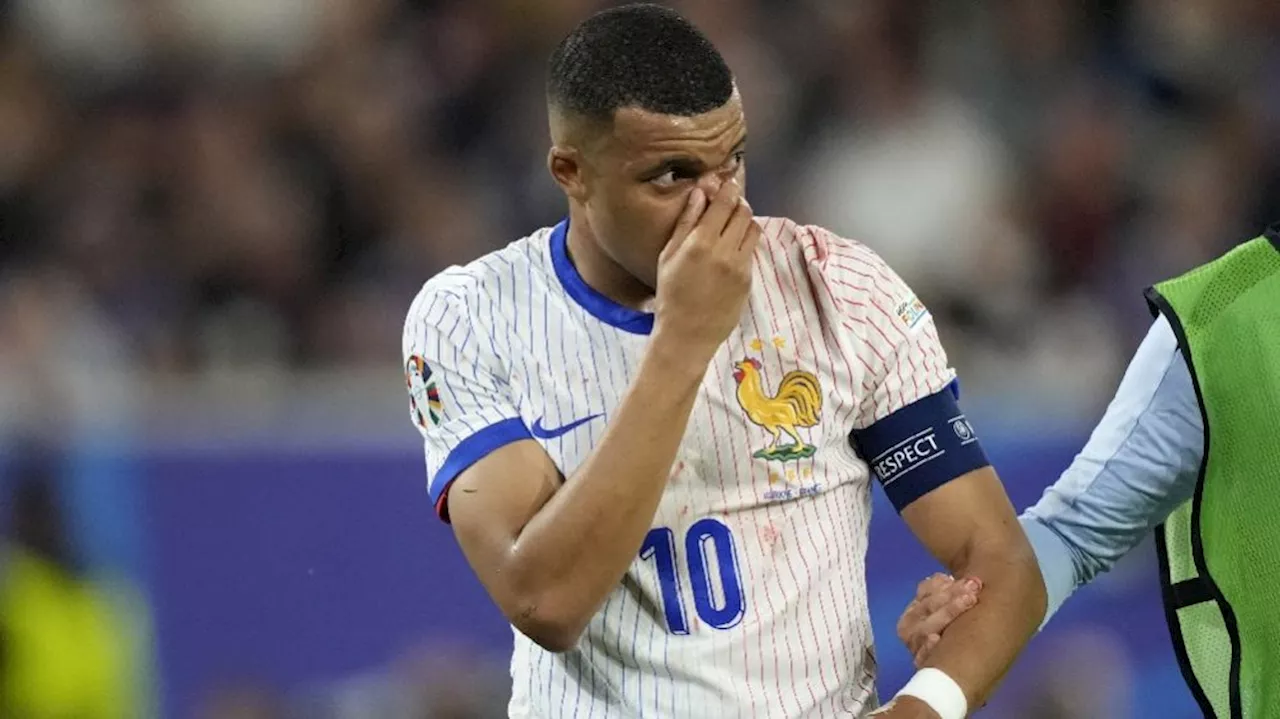 Euro 2024: Tras fractura, Kylian Mbappé pidió ideas para máscaras y esto pasó