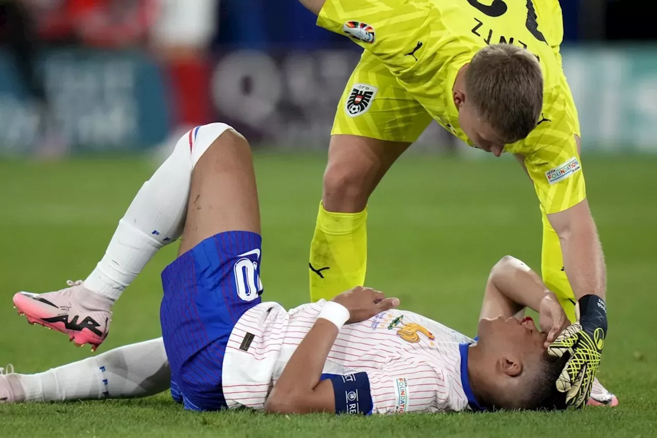 Kylian Mbappé sustained a broken nose at Euro 2024, but France gets