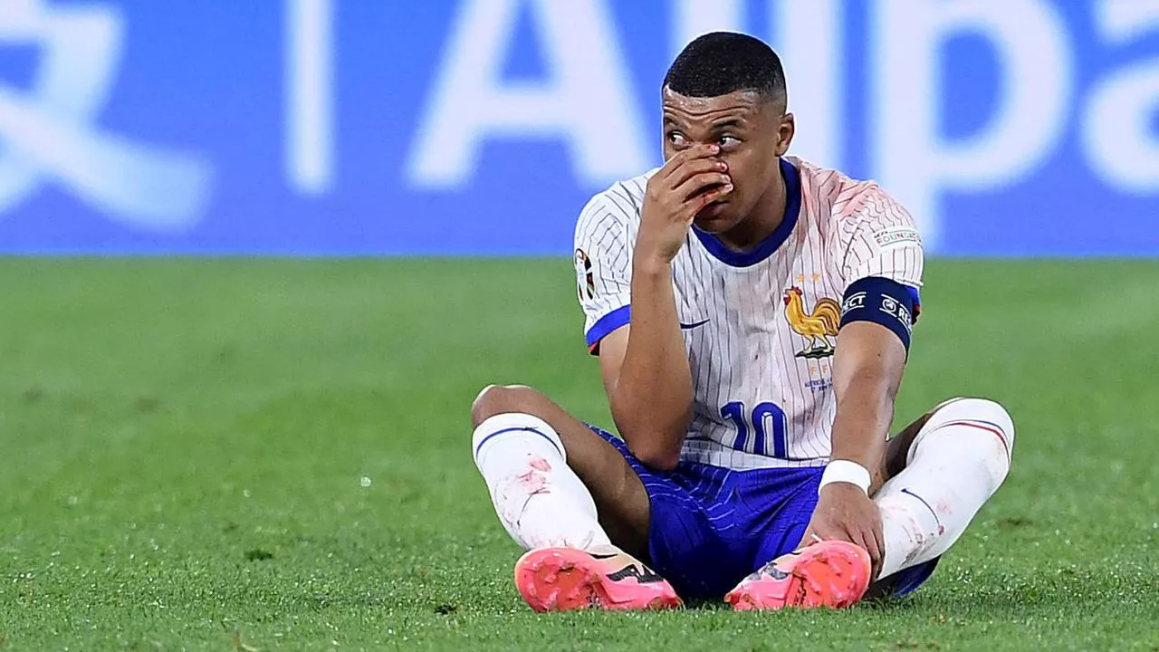 Nasenbeinbruch: Frankreich-Star Mbappé verletzt