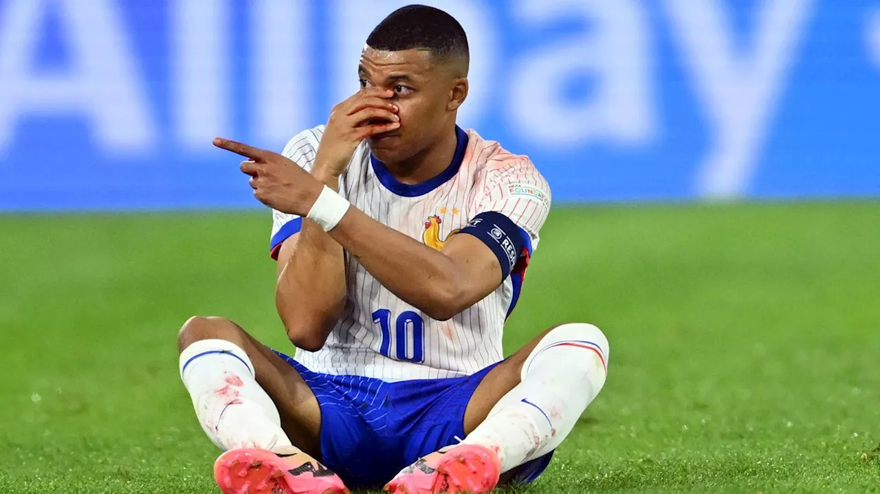 Verletzter Kylian Mbappé – Frankreich und die Nase der Nation