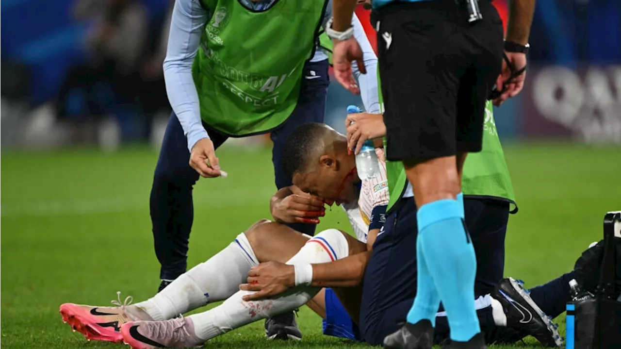 Kylian Mbappe breaks nose in France’s Euro 2024 win