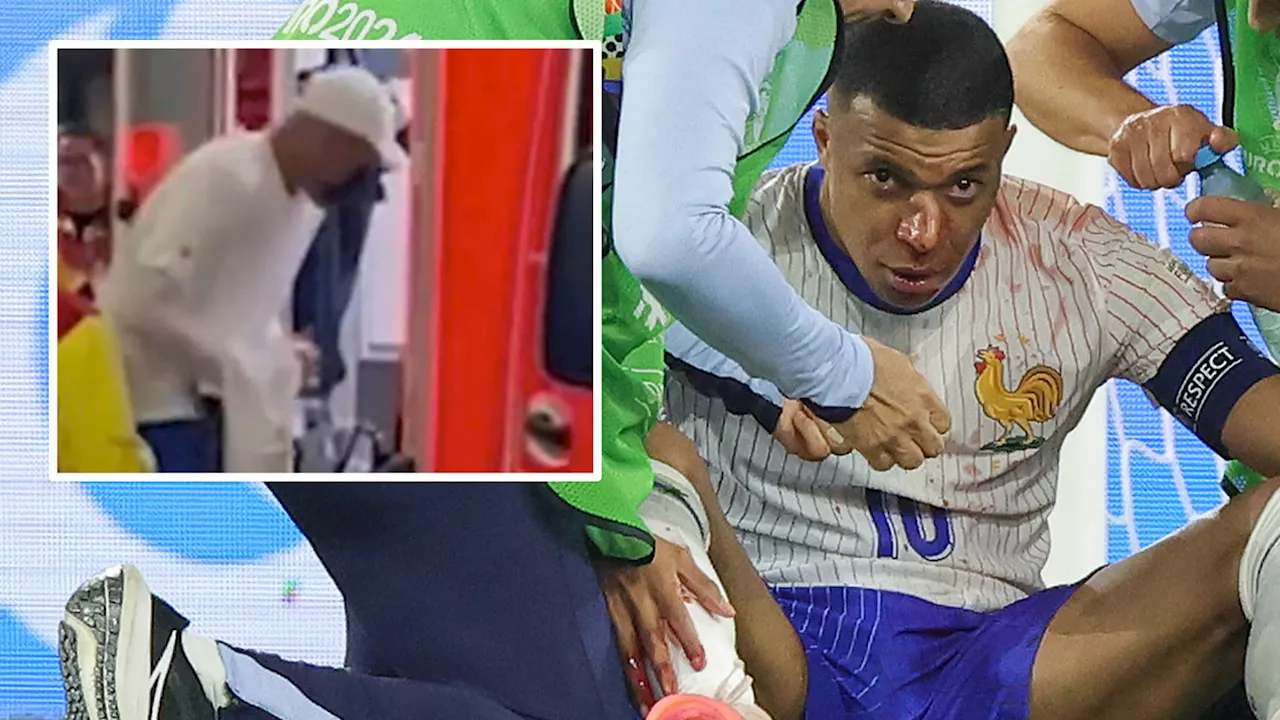 Kylian Mbappe rushed to hospital with broken nose with France star to undergo surgery after leaving...