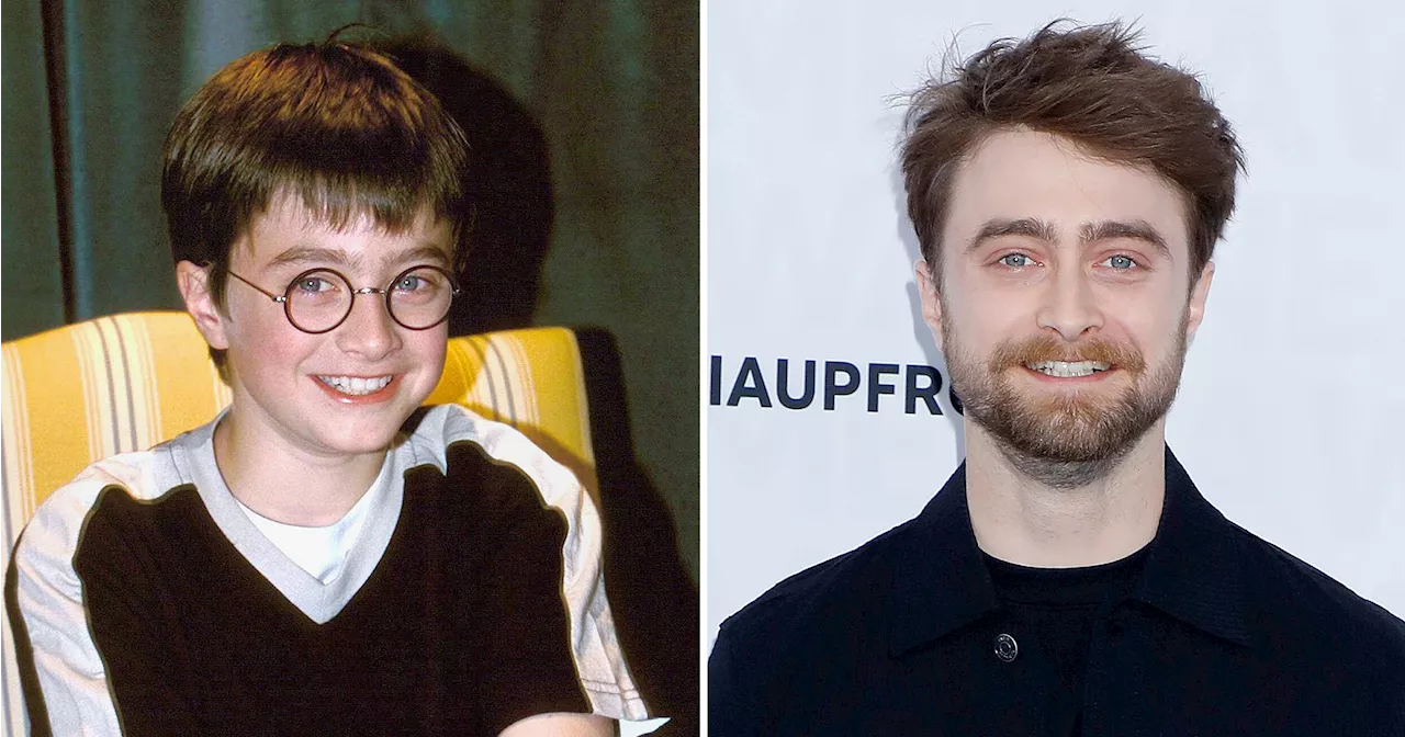 Daniel Radcliffe Through the Years: From Harry Potter to Tony Winner