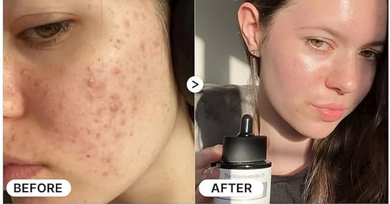 Amazon' £20 'little bottle of miracles' serum that gives a 'youthful glow'