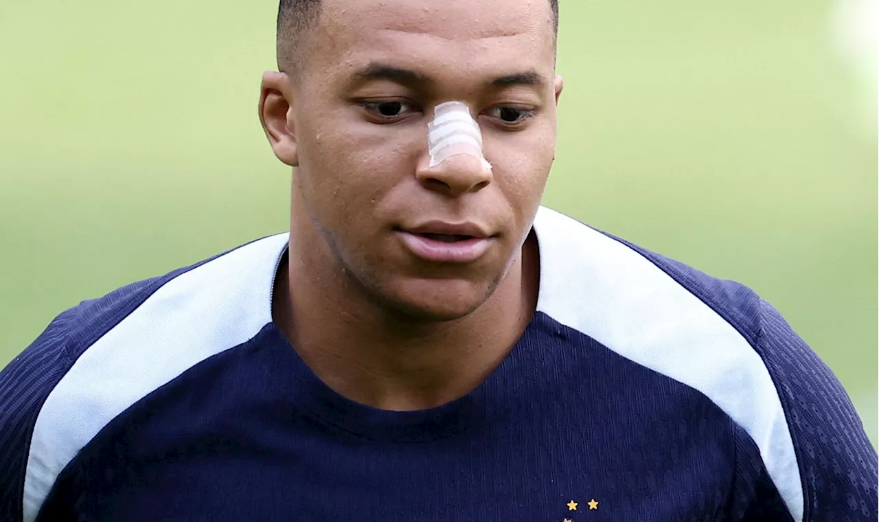 Sem máscara, Mbappé aparece com curativo no nariz no treino da França