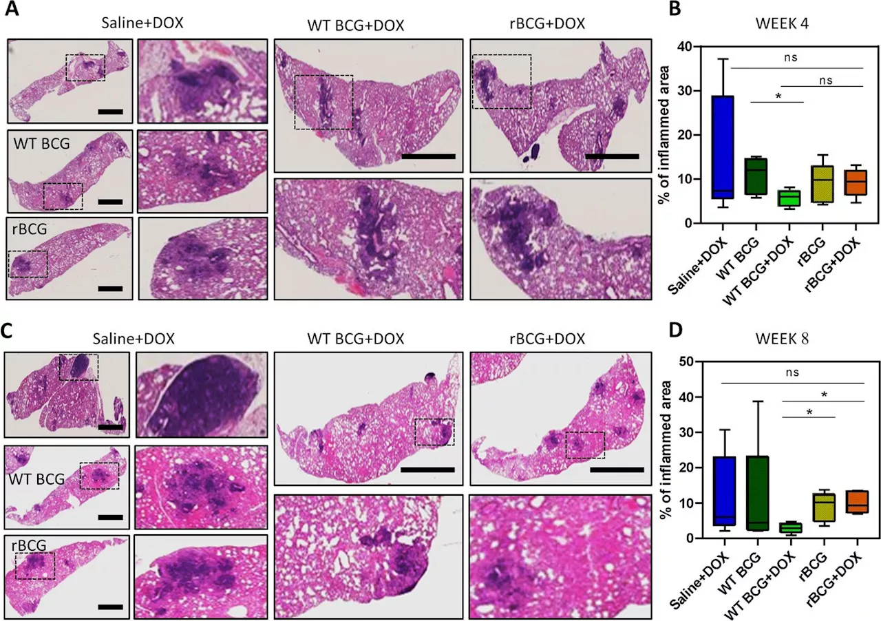 Researchers discover a potential vaccine to prevent tuberculosis in people of all ages