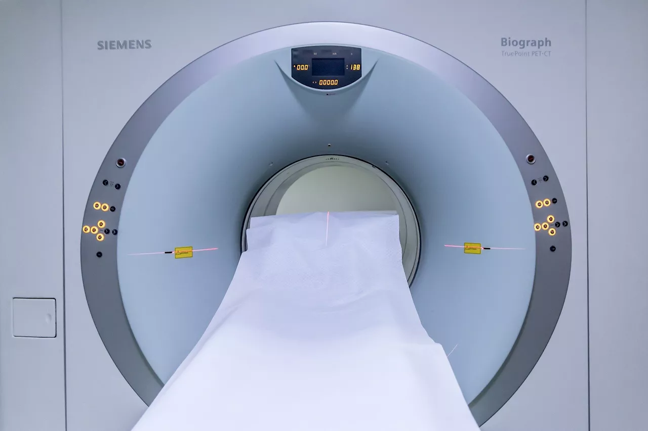 Researchers discover a significant problem in brain imaging and identify a fix