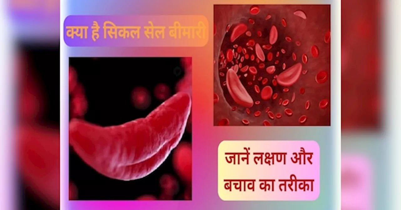 Sickle Cell: सिकल सेल बीमारी क्या है, जिसकी चपेट में झारखंड की बड़ी आबादी, जानें लक्षण