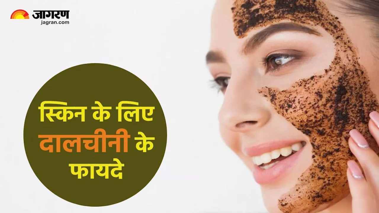 दालचीनी का इन तरीकों से इस्तेमाल दिलाएगा Pimples से छुटकारा, चेहरे की रंगत में भी होगा सुधार