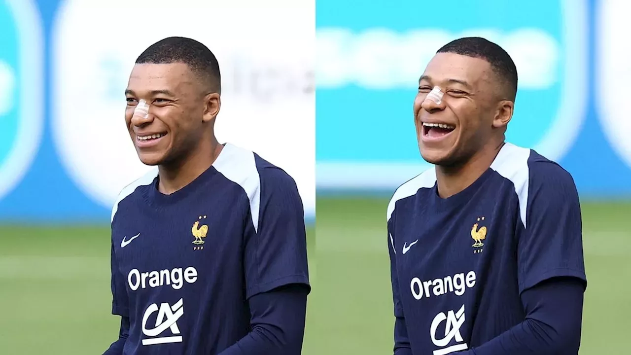 Francia: Kylian Mbappé Con Máscara: Así Jugará Con Francia El Resto De ...