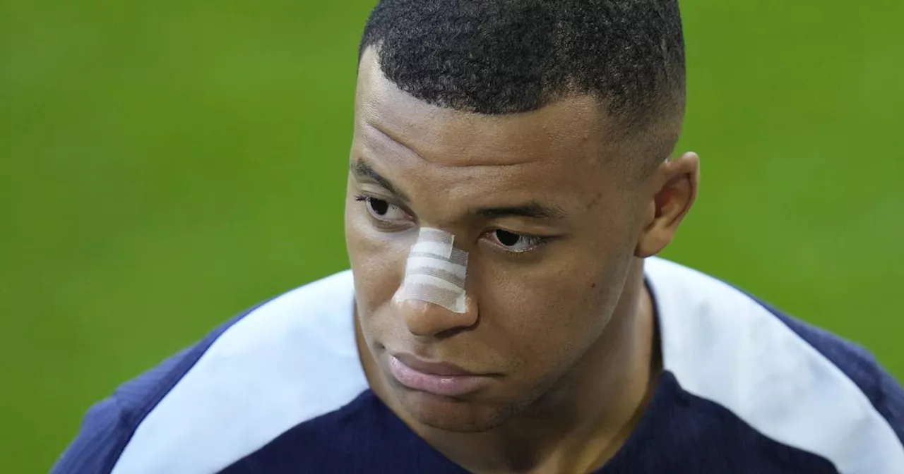 EM 2024: Frankreich hofft gegen die Niederlande auf Maskenmann​ Mbappé