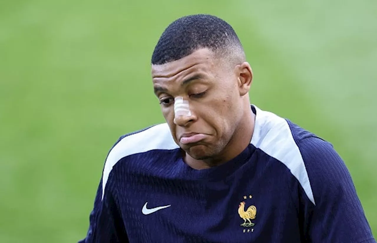 Real Madrid 'React' To Mbappe Breaking Nose