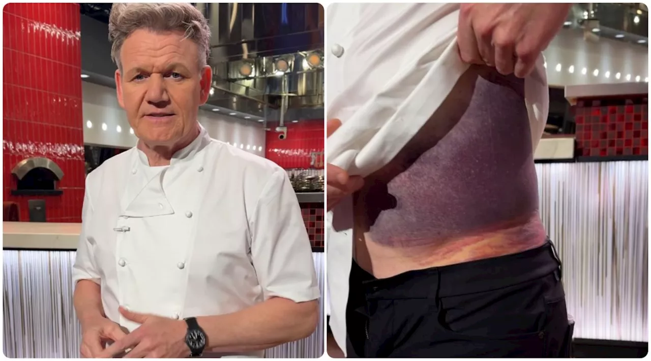 Gordon Ramsay says he's lucky to be alive after near-fatal cycling accident