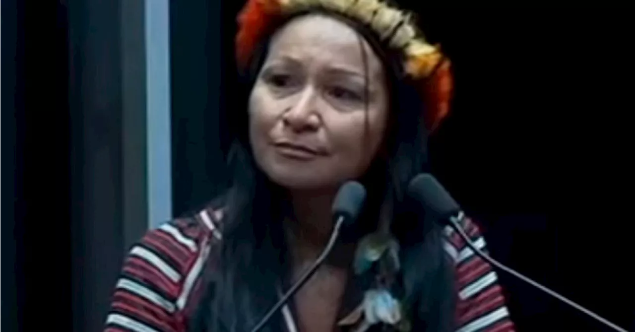 Silvia Waiãpi é cassada por usar verba pública em harmonização facial