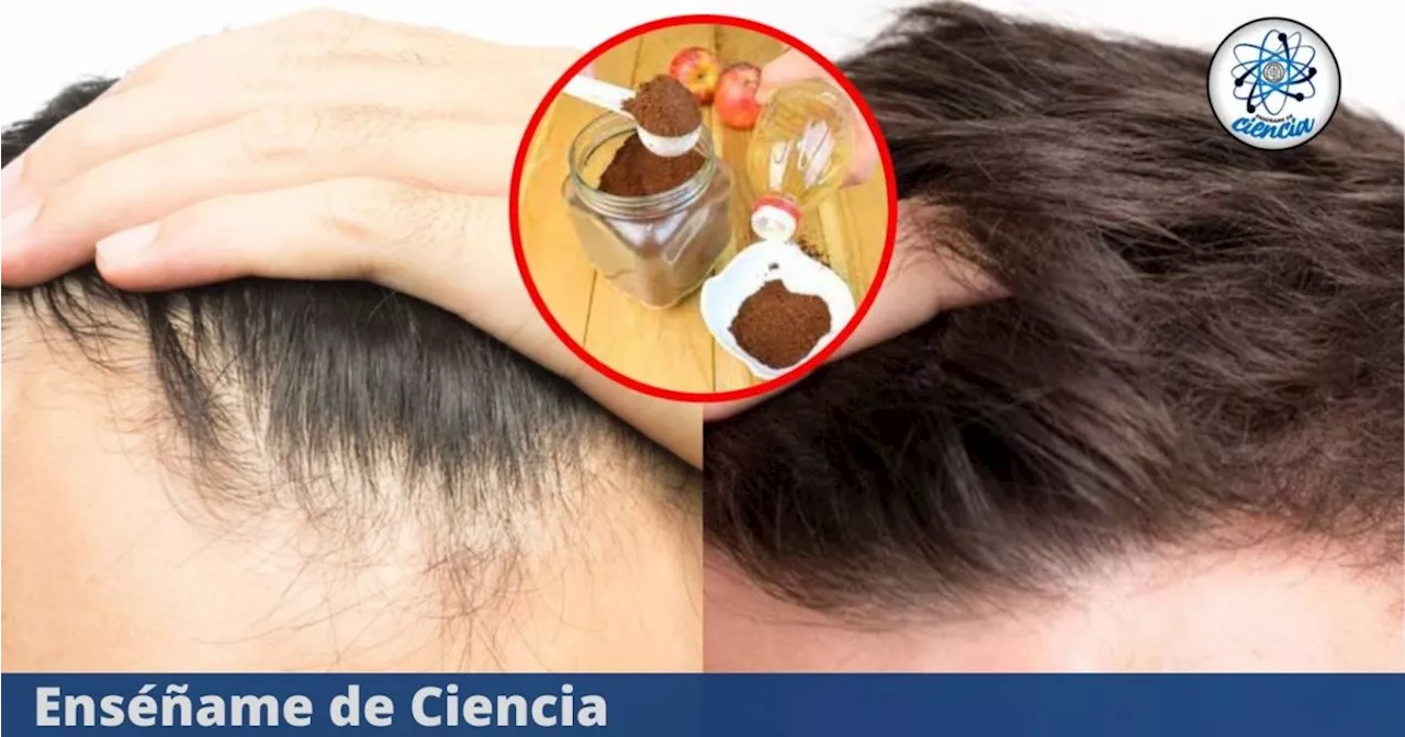 Alopecia a raya: Descubre estos 3 ingredientes efectivos para evitar su aparición y conservar un cabello fuerte