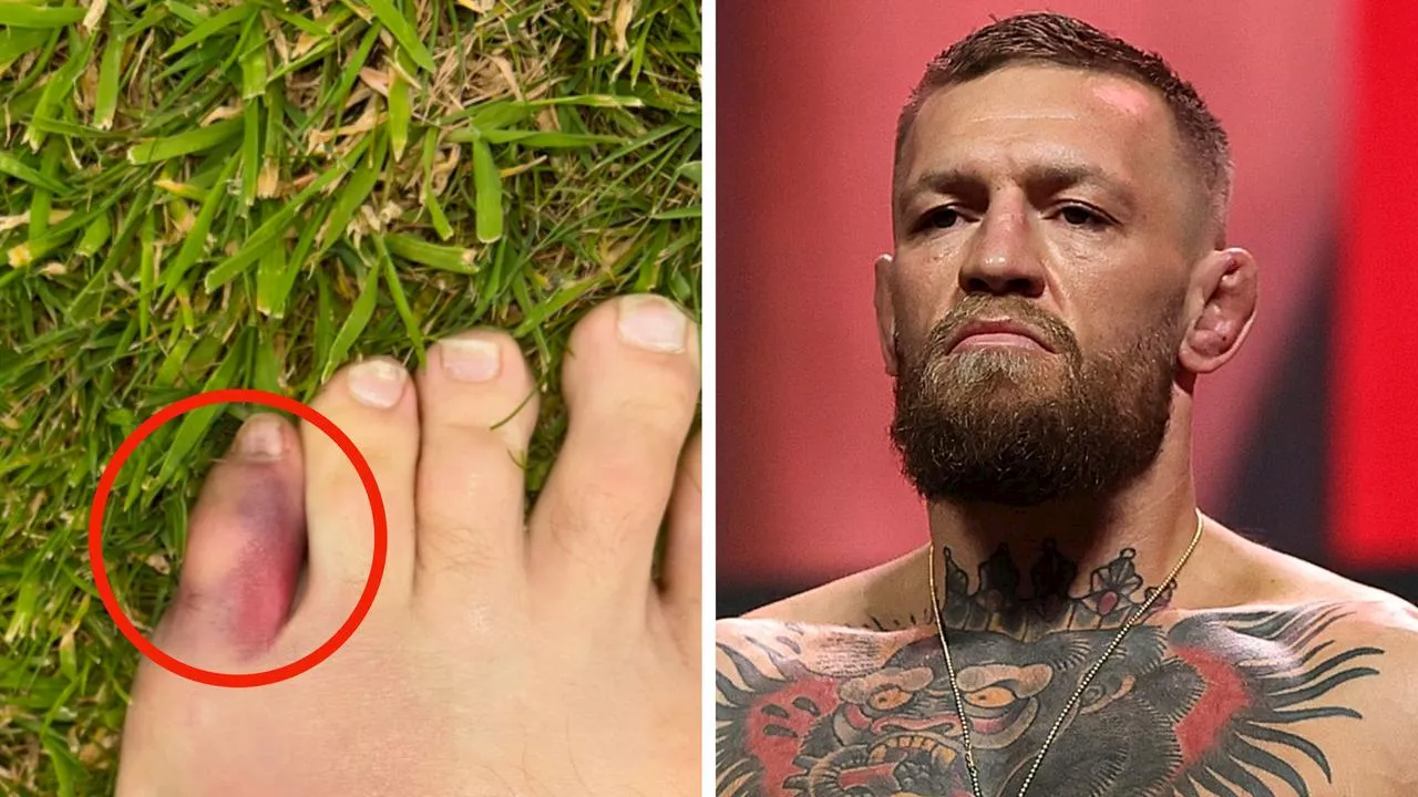 ‘Slight lapse in concentration’: McGregor reveals nasty injury behind sad UFC 303 withdrawal