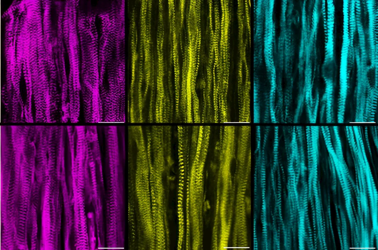 Lab-grown muscles reveal mysteries of rare muscle diseases