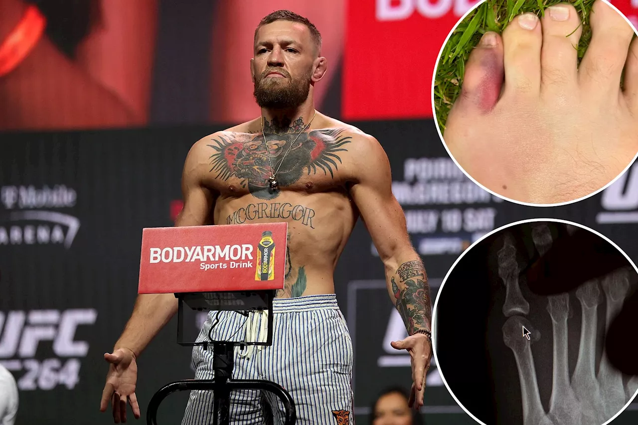 Conor McGregor reveals injury that forced him out of UFC 303