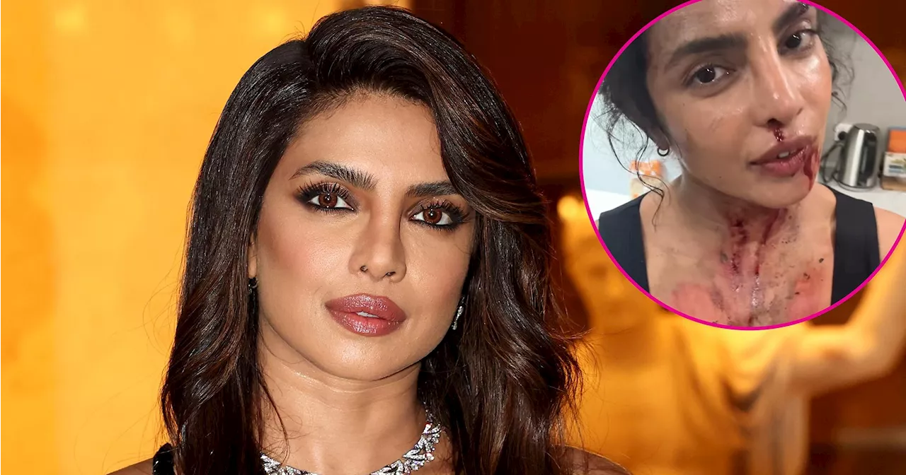 Priyanka Chopra Is Bruised, Bloody on Set of New Movie 'The Bluff'