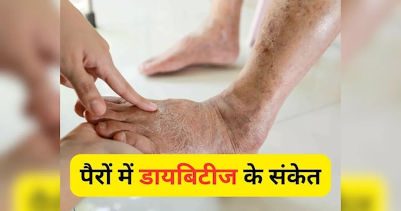 Diabetes Symptoms: पैरों में झुनझुनाहट, सूजन... इस तरह मिलते हैं डायबिटीज के संकेत, इग्नोर करने की ना करें गलती