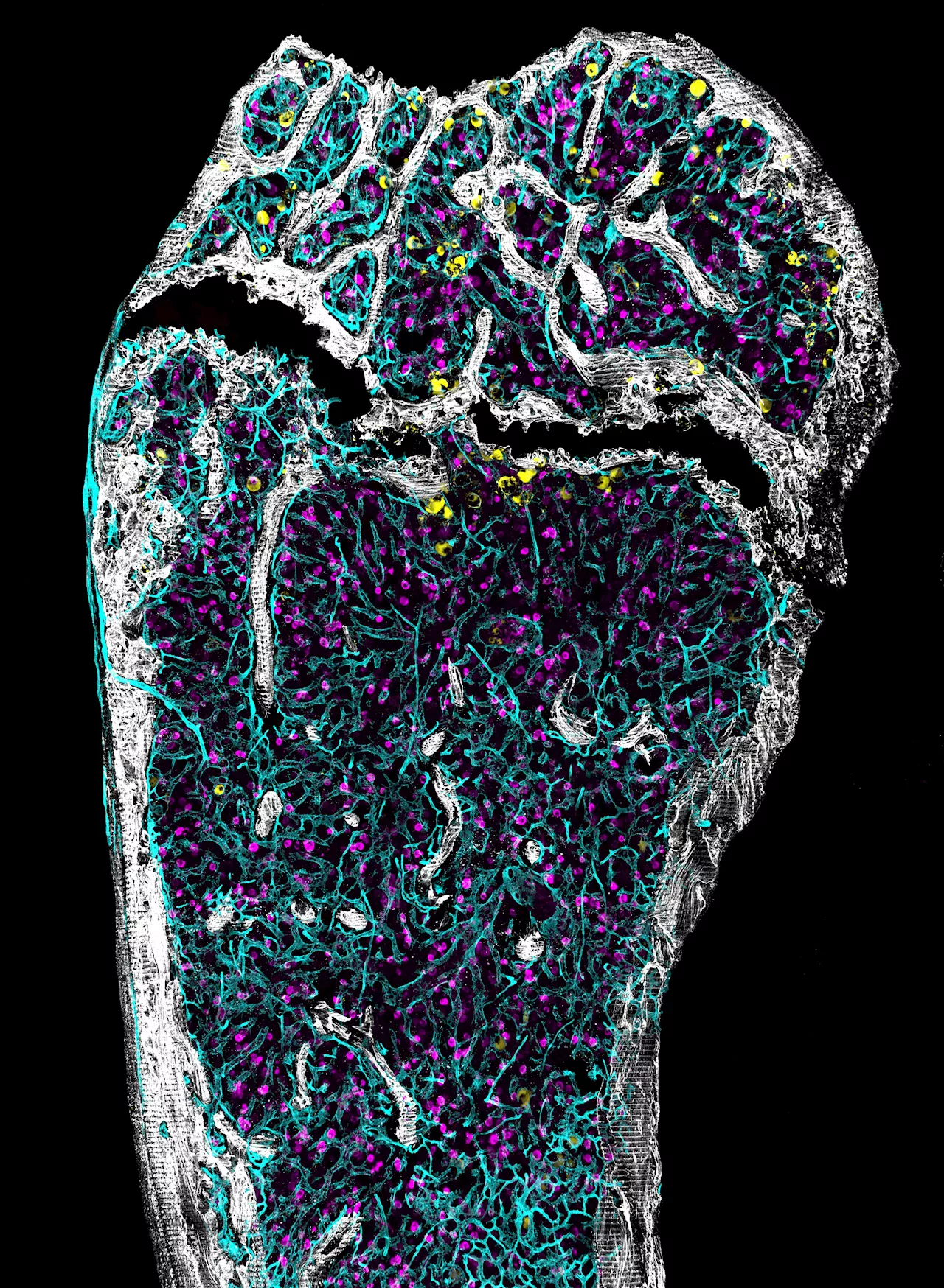 Growth factors linked to stem cell aging in bone marrow study