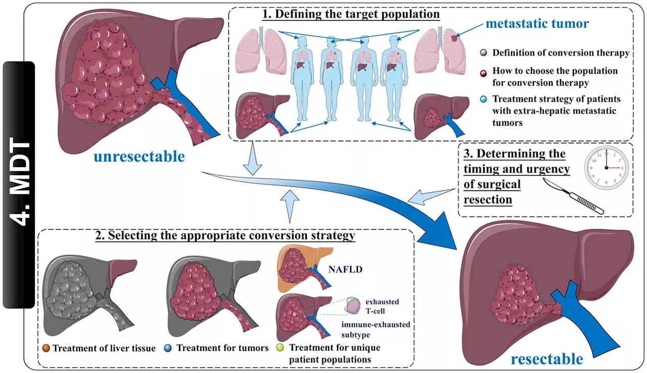 Improving the conversion success rate of hepatocellular carcinoma