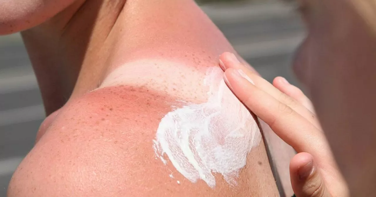 Warum man nie Sonnencreme aus dem letzten Urlaub nutzen sollte​