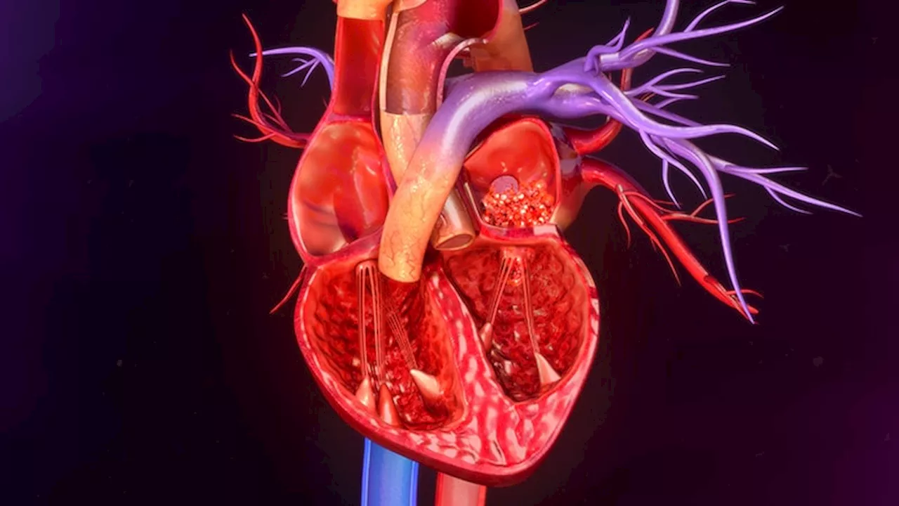 SELECT: Semaglutide Reduces CV Events and Diabetes Risk