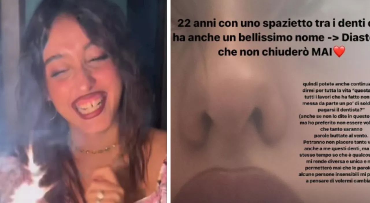 Giulia Stabile sbotta e risponde a chi le dice di andare dal dentista: «I miei denti storti mi rendono unica e