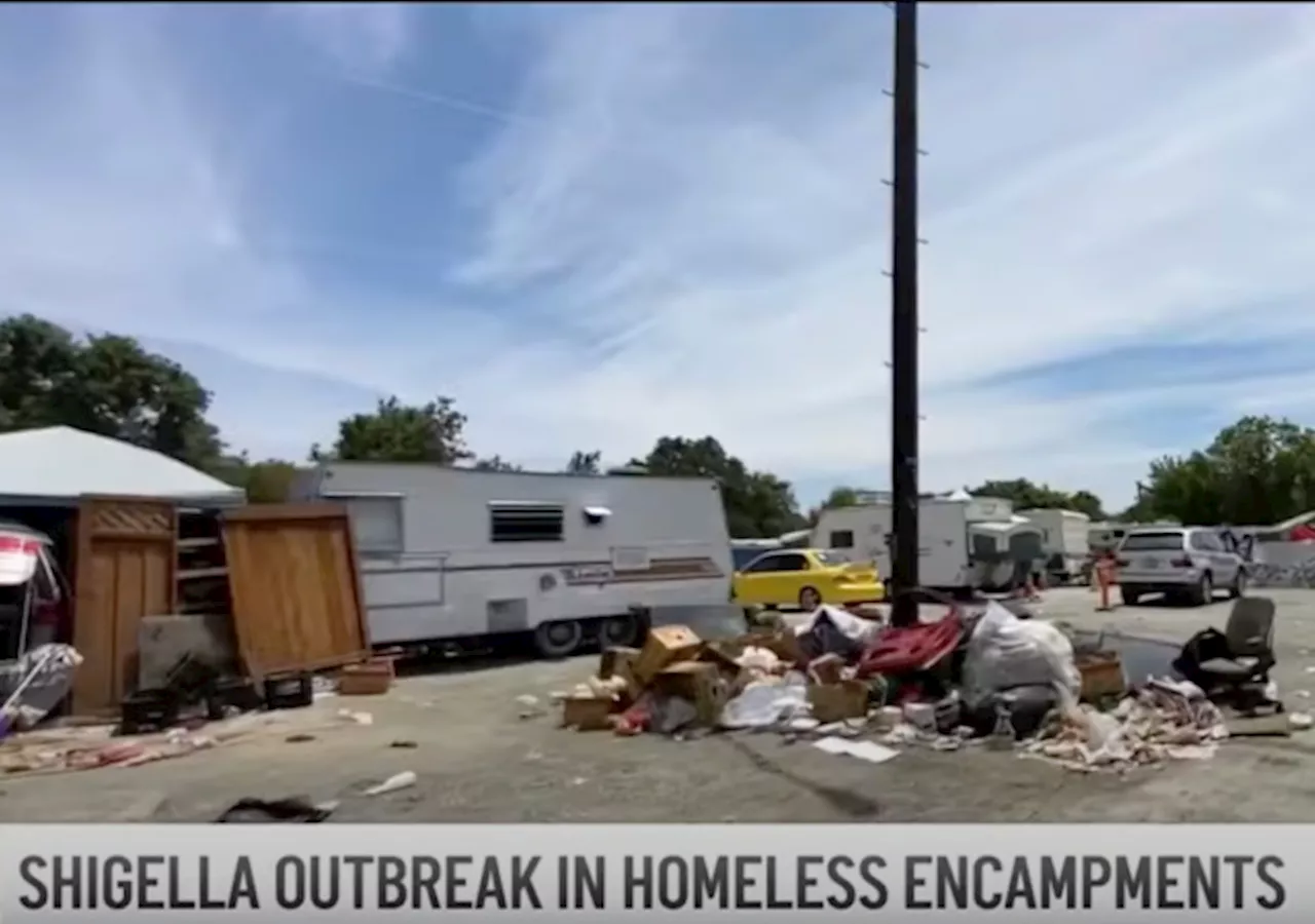 Shigella Spreading Fast in San Jose, CA, Homeless Encampments