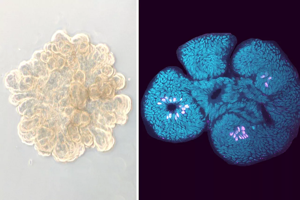 New study demonstrates the efficacy of a promising celiac disease drug at the molecular level