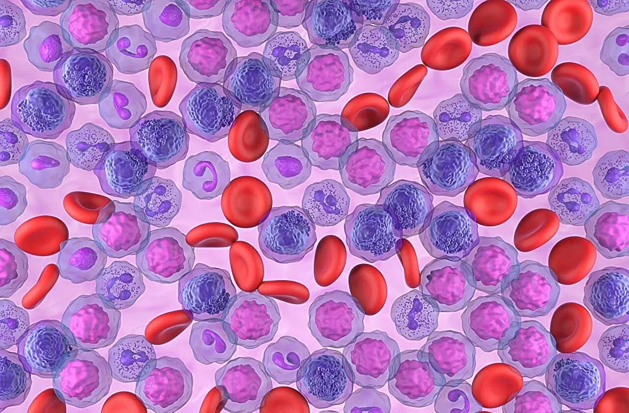 Post-transplant cyclophosphamide GVHD prophylaxis beneficial in leukemia