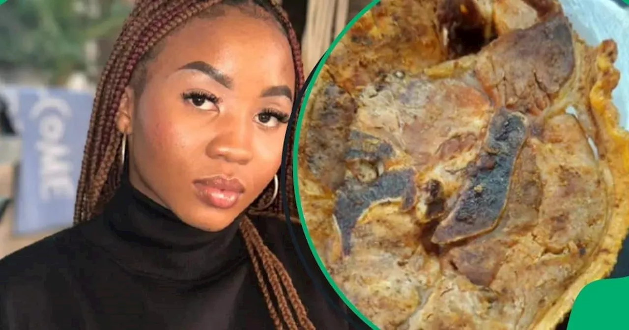 “I Didn’t Even Know I Was Allergic to Pork”: Woman Shares Horrifying Allergic Reaction