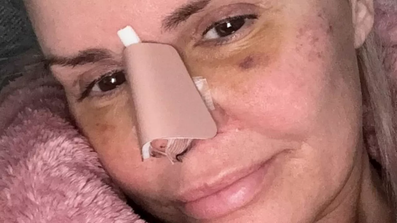 Kerry Katona reveals worrying health update following her nose job as doctors notice 'advanced'...