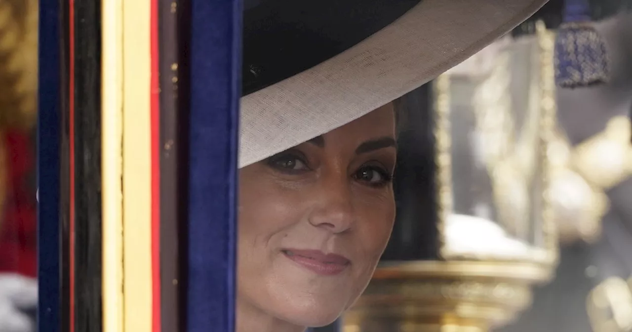 Kate Middleton, rumors drammatici: &#034;Due ore di trucco per nascondere tutto&#034;