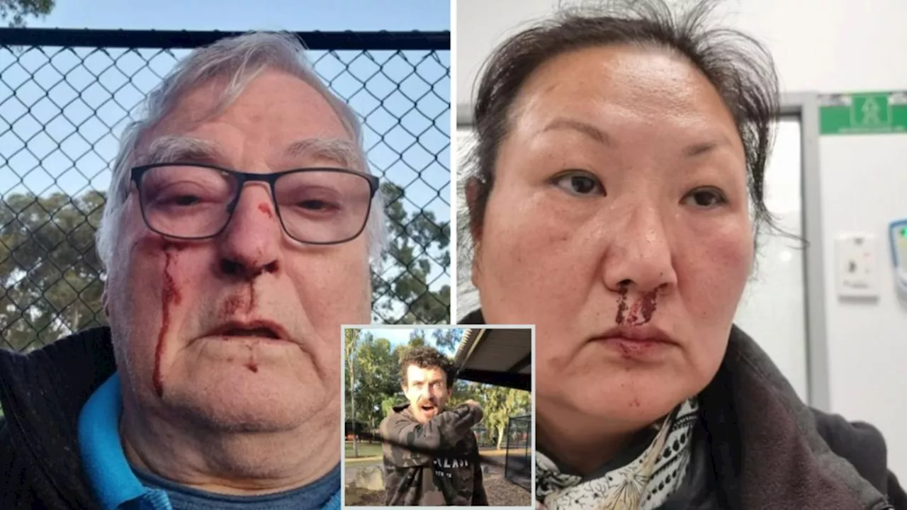 Adelaide couple assaulted at Fremont Park dog park in Elizabeth