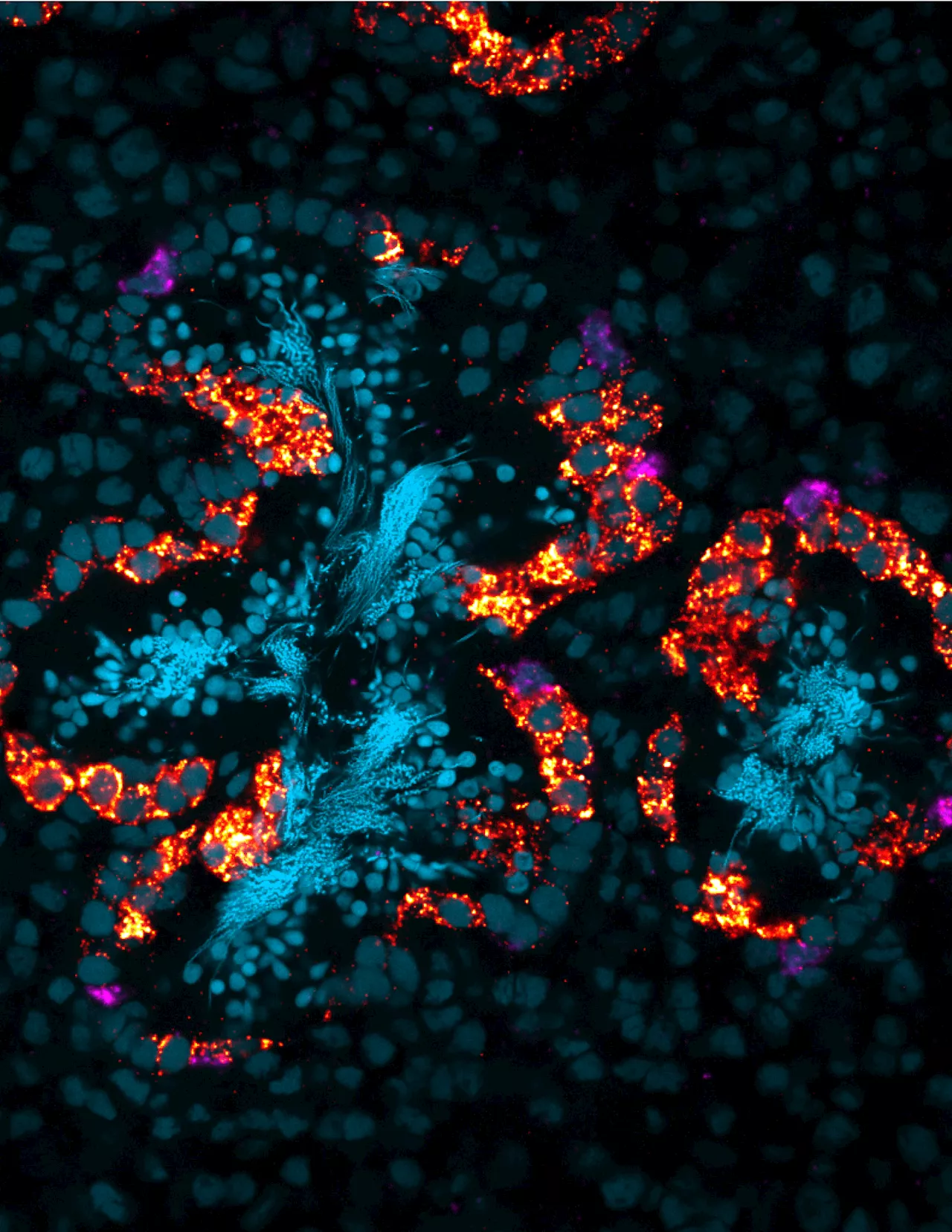 Following the 'BATT Signal:' A new signaling pathway controlling planarian germ cells