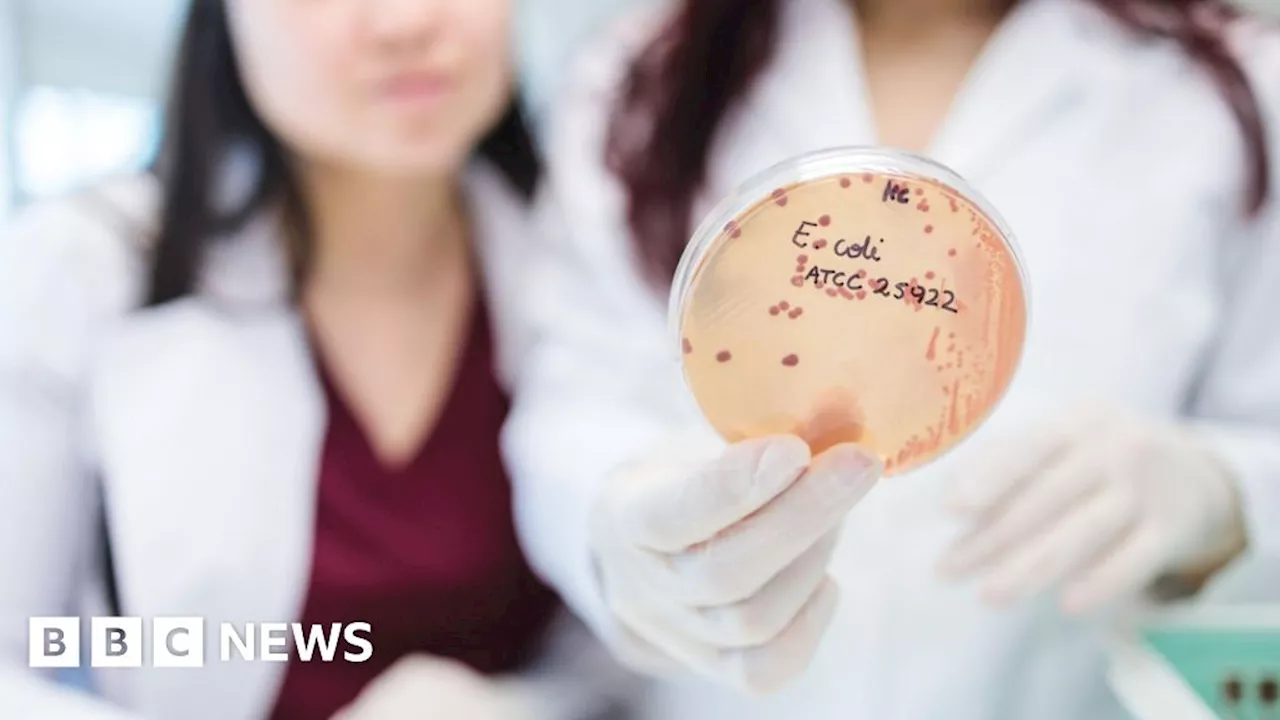 E.coli: 31 cases confirmed in Wales, almost half hospitalised