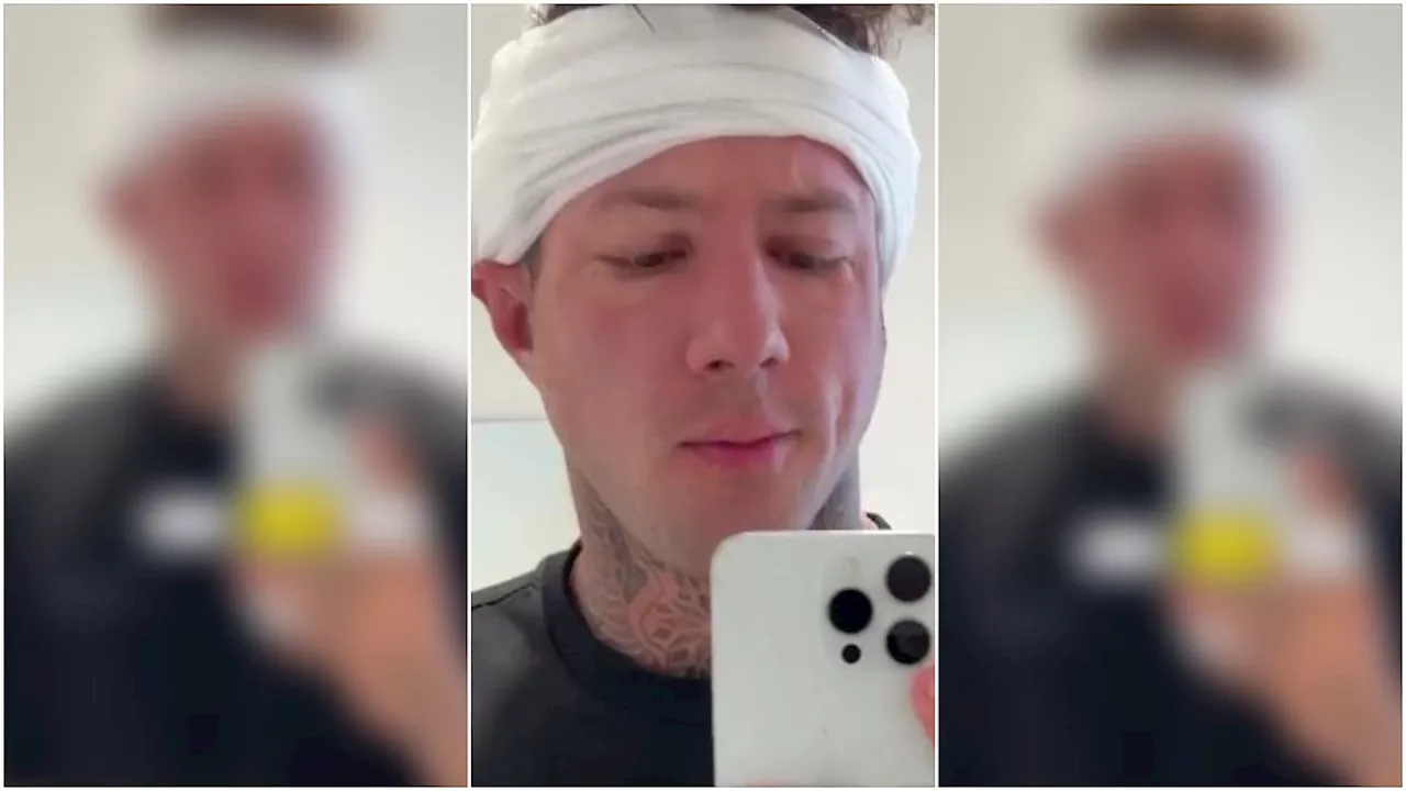 Christian Wolf hat Geheimratsecken? Haartransplantation überrascht Fans