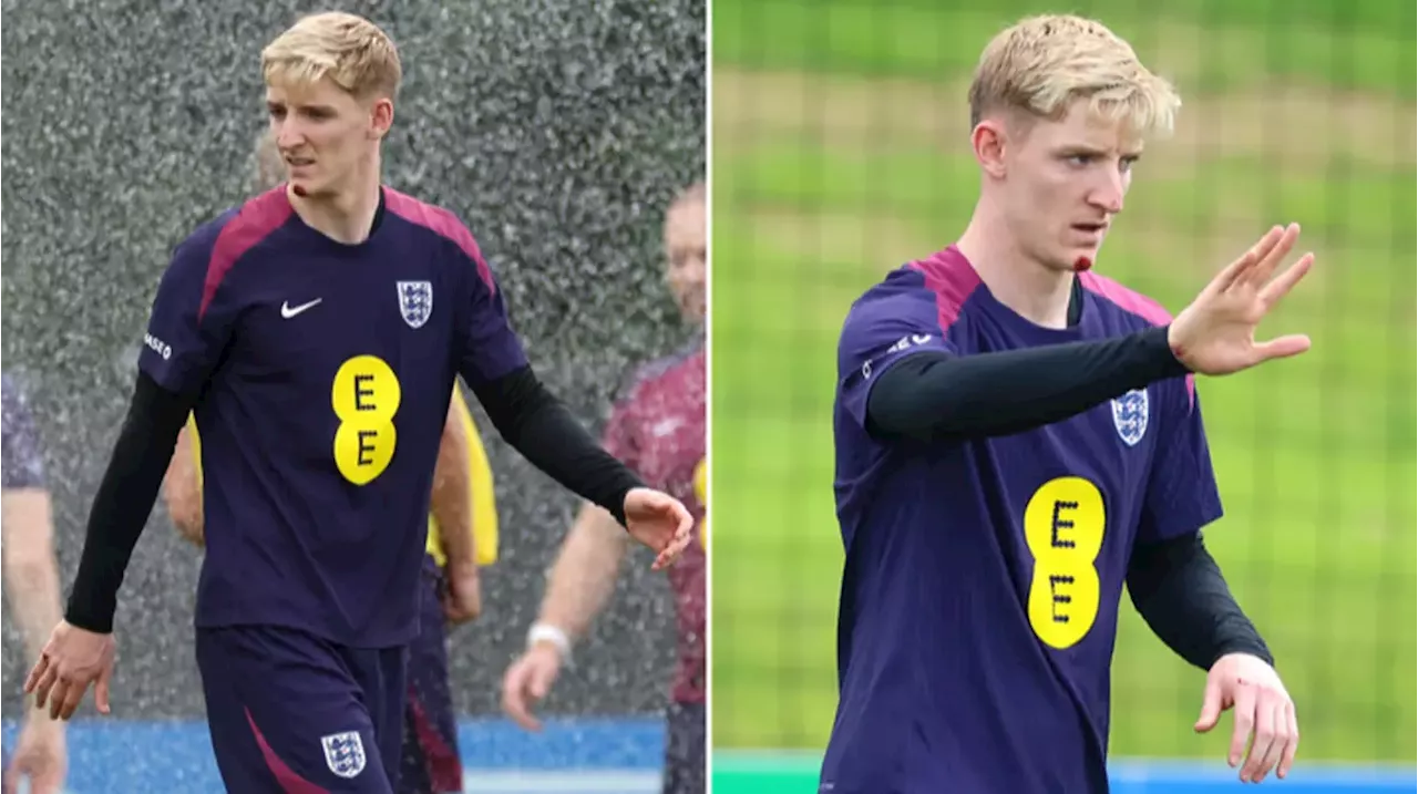 Anthony Gordon suffers embarrassing injury days before England's Euro 2024 clash with Slovakia