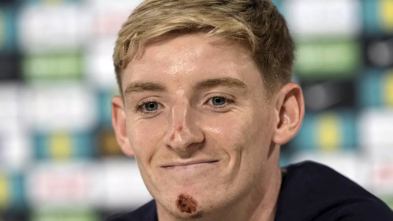 England winger Gordon escapes serious injury from bike accident during downtime at Euro 2024