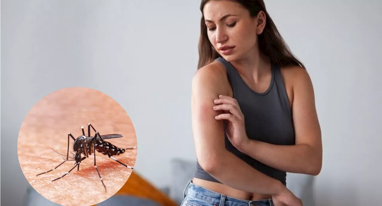 ¿Por qué un mosquito pica más a una persona que a otra?