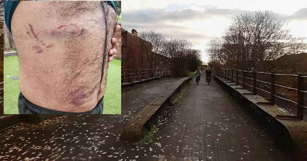 Glasgow man calls for CCTV to keep cyclists safe after 'terrifying' bike path attack