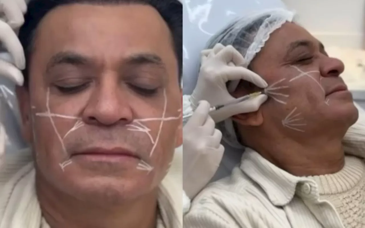 Frank Aguiar revela nova harmonização facial: '53 com carinha de 33'